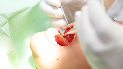 歯牙移植・親不知の抜歯